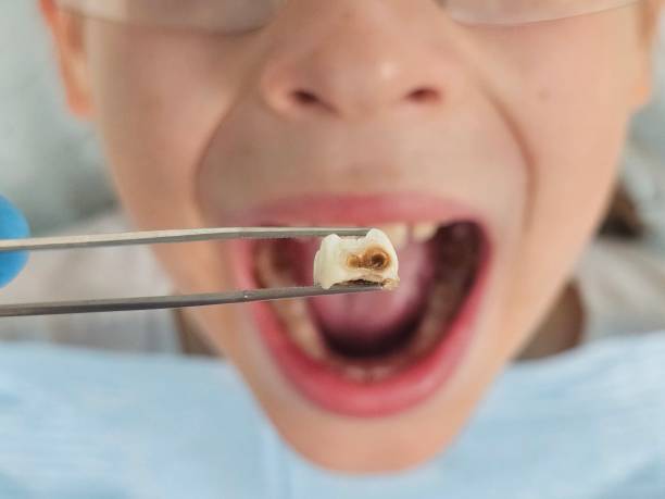 Best Cosmetic Emergency Dentistry in Walnut Grove, CA
